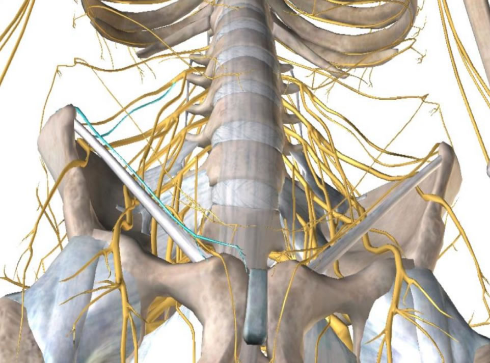 Complex pelic areas with nerves