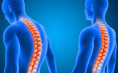 Posture Article in the Guardian featuring Tim King and the CiONE Wellness Centre