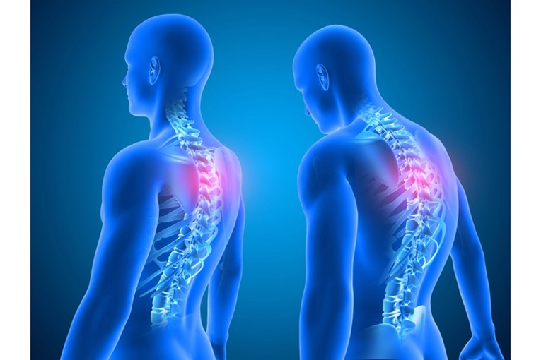 Posture pressure
