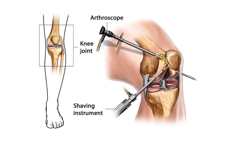 Bio Fascial Release For Knee Pain