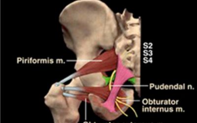 Pudendal Neuralgia